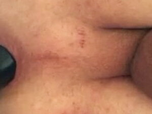 Anal